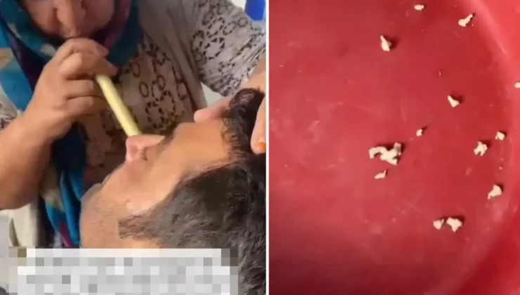 Hindistan değil Adana! Bu saçmalığa inanıp tedavi için gidenler var