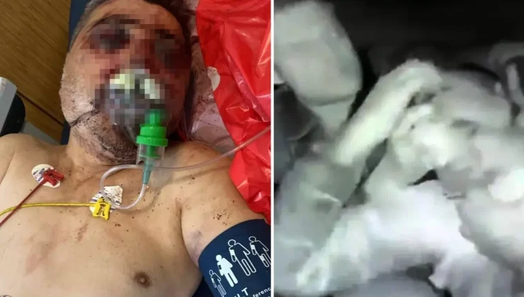 İngiliz boksör tarafından öldüresiye dövülen taksici dehşet anlarını anlattı